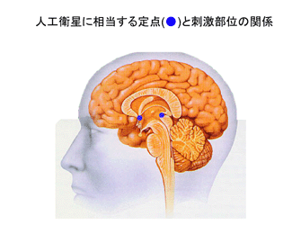 brain_map_electrode_anime.gif